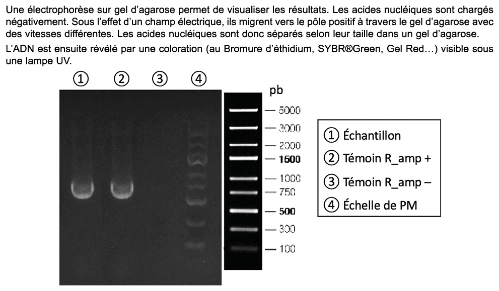 Une lectrophor se sur gel d’agarose permet de visualiser les r sultats. Les acides nucl iques sont charg s n gativem...